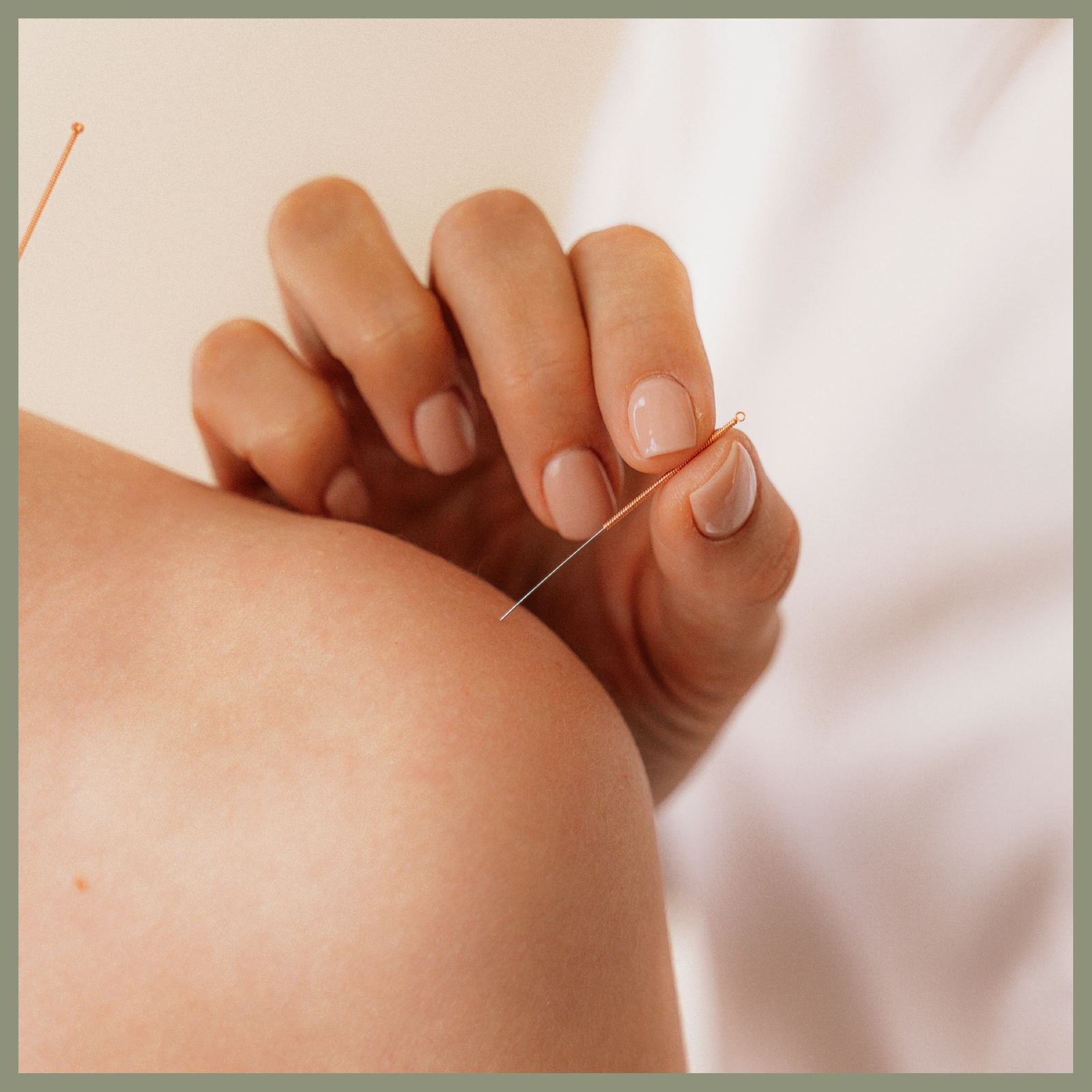 Terapias Holísticas en Barcelona y Mataró - Angeles Corral - Sesiones de Acupuntura en Barcelona y Mataró - Angeles Corral