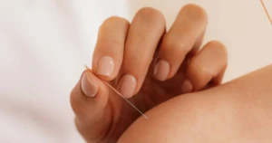 Lee más sobre el artículo Primera sesión de acupuntura en Barcelona: qué esperar paso a paso